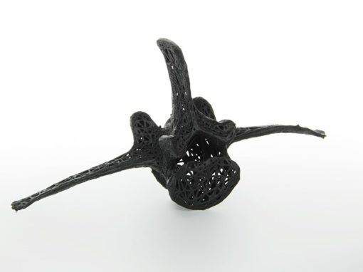 Single Vertebra
