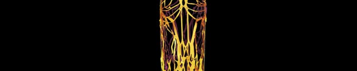 Yellow Silk Ligaments